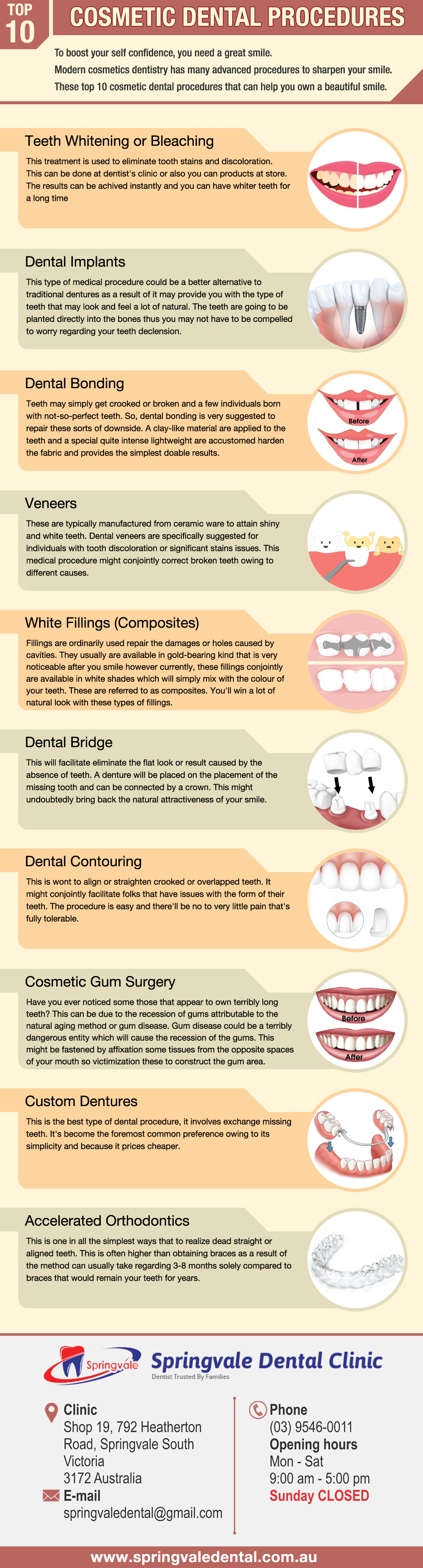 For Your Smile 10 Most Popular Cosmetic Dentistry Procedures