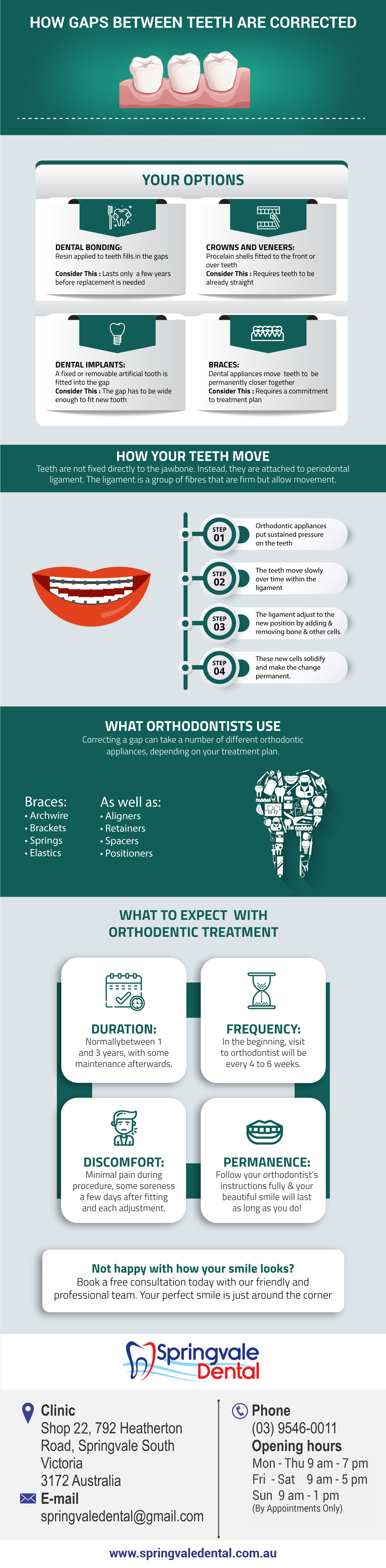 How Gaps Between Teeth Are Corrected | Infographic