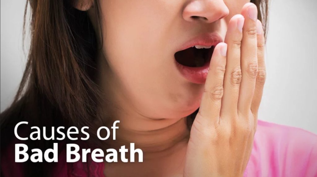 Know the Causes Of Bad Breath | Springvale Dental Clinic Blog