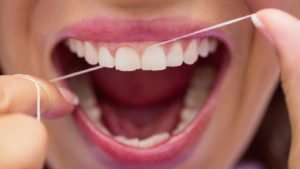 Why Do Gums Bleed While Flossing? | Springvale Dental Blog